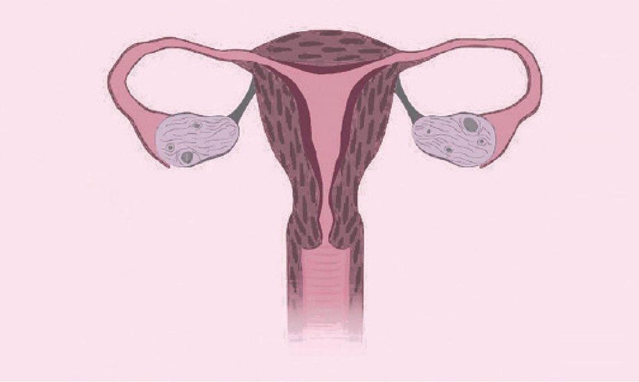 KITARAN haid berlaku setiap 28 hingga 30 hari.