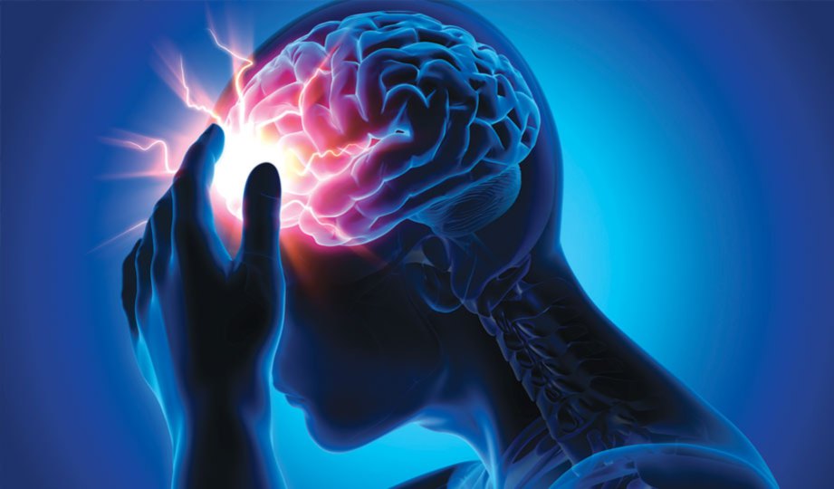 EPILEPSI atau sawan ialah masalah neurologi yang boleh berlaku kepada sesiapa saja.