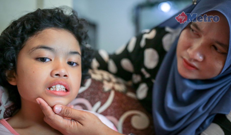 ROHAYU menunjukkan kesan serangan penyakit sawan dihidapi anaknya. FOTO Nurul Syazana Rose Razman.