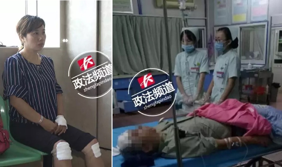 Yu (kiri) cedera ringan manakala suaminya dirawat di ICU. - Foto SCMP