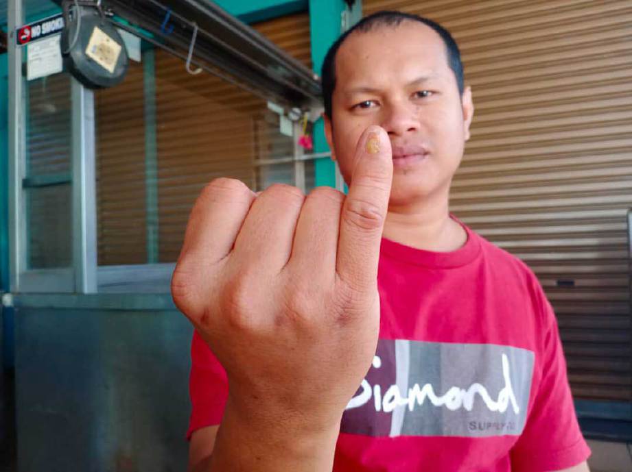 MUHAMMAD Rizal Afnan menunjukkan jari kelingking kanannya yang patah. FOTO Ihsan Muhammad Rizal Afnan