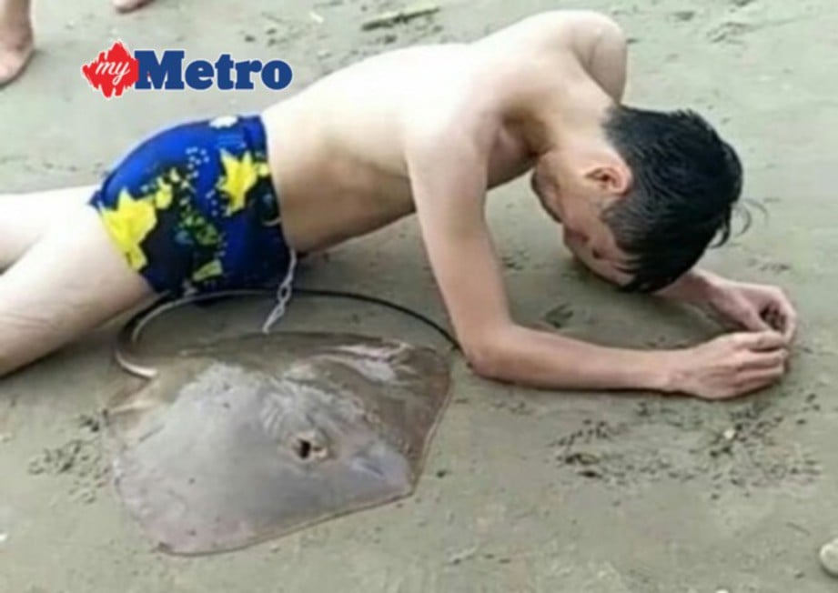 SEORANG lelaki China kesakitan menahan tusukan duri ikan pari.  FOTO/WEIBO