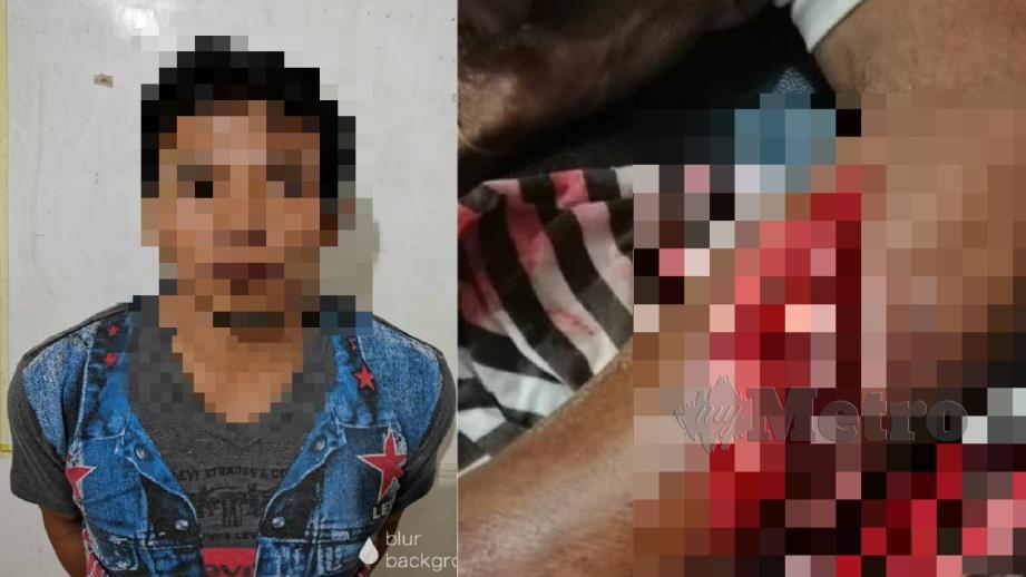 Lelaki yang disyaki menetak rakannya dan (gambar kanan) keadaan tangan mangsa yang cedera dalam kejadian di Lahad Datu. Foto Ihsan PDRM