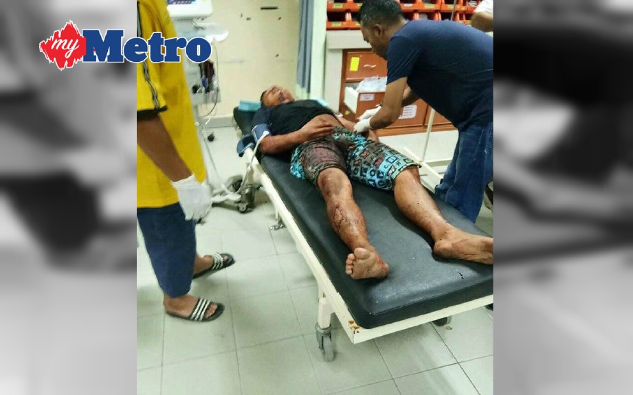 Mangsa yang cedera parah ditinggalkan di depan klinik. FOTO Ihsan PDRM dan FB Gabungan Anak Terengganu