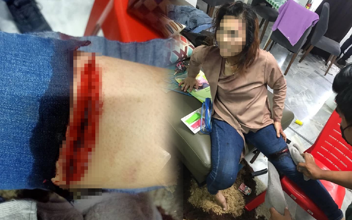 MANGSA cedera dibelasah teman lelaki kerana cemburu di Bandar Puchong Jaya. FOTO IHSAN PDRM