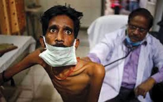 PESAKIT TB susut berat badan dan batuk berdarah tanpa henti.