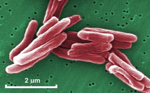 KUMAN TB dilihat menerusi mikroskop.