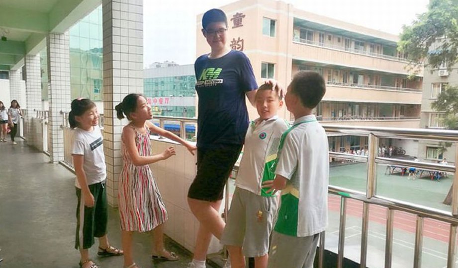 XIAOYU kelihatan terlalu tinggi berbanding rakannya. FOTO Chengdu Economic Daily