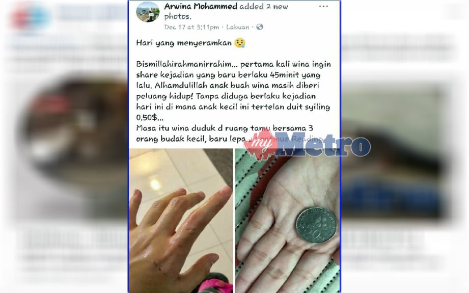 Status Facebook Arwina menunjukkan tangannya yang masih basah dan terdapat kesan gigi Izul dan duit syiling 50 sen selepas memasukkan tangan ke dalam mulut kanak-kanak itu. FOTO Ihsan Arwina Mohammed 