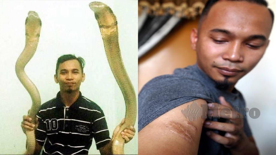 Syafiq bersama ular yang ditangkapnya (gambar kiri) serta kesan patukan ular pada tangannya (gambar kanan). FOTO Ihsan Pembaca