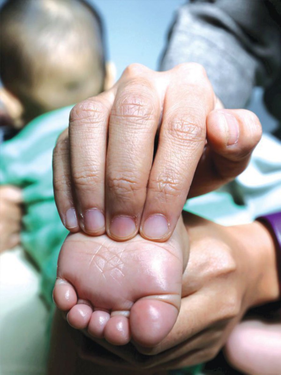 LANGKAH 2: Letak empat jari mengikut posisi gambar, tekan lembut sambil melipat genggam ke hujung tapak kaki bayi. 