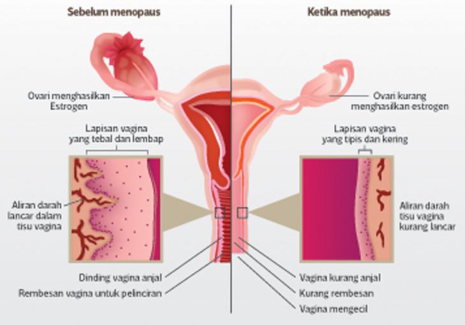 PERBANDINGAN antara vagina lembap (kiri) dan vagina kering.