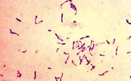 BAKTERIA Corynebacterium diphtheria dilihat menerusi mikroskop.